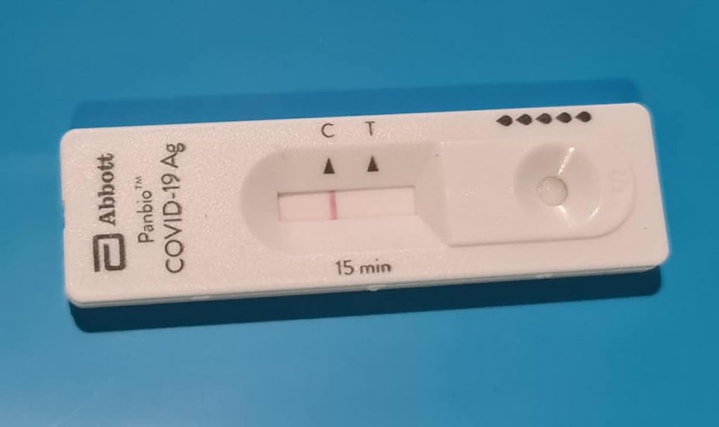 Test COVID del alcalde Gonzalo Pérez Jácome
