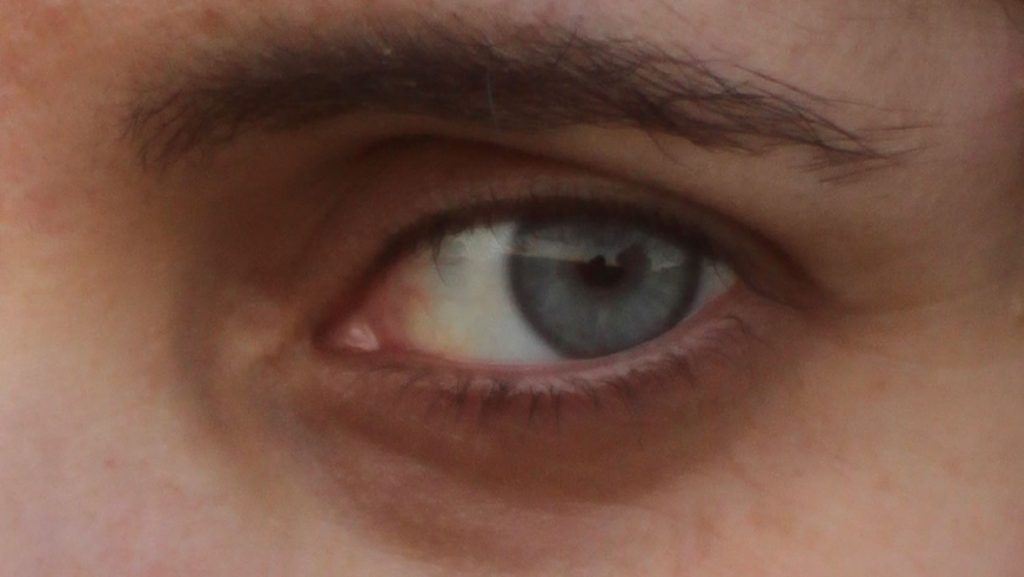 Ojo vista